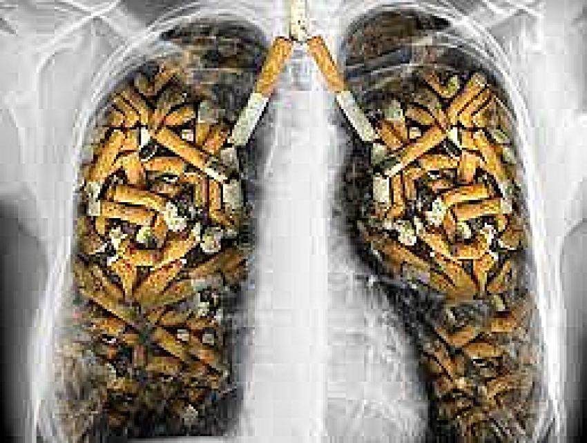 Sigara ve Akciğer kanseri
